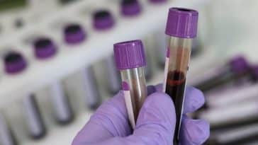 Do Private Exams fix the Anion Gap?