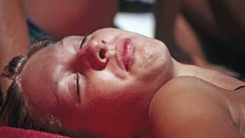 Do Sunburn and Relief Tips Help?