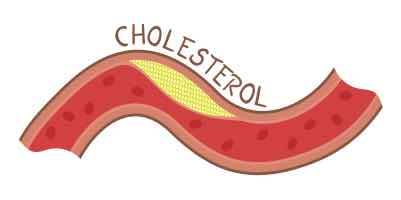 Do Arterial Problems need help?