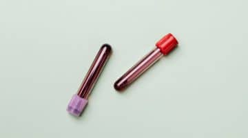 Is your genetics Linked To Coronavirus Risk?