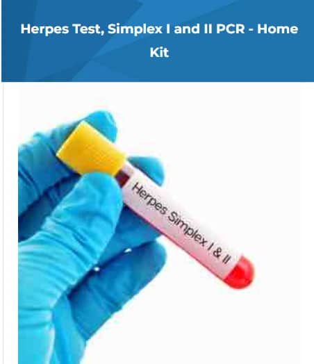 Herpes Test HSV Type MBMD