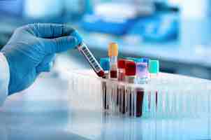 Revolutionizes Blood Analysis