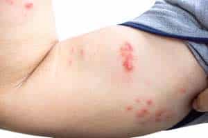 Guidelines: Who Should Get Checked?