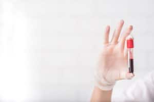 I looked pregnant, my stomach, is hard. Cancerous Ovary?