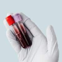 Would organ removal shock your life?