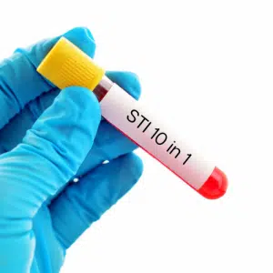 STI test 10 in 1 home kit