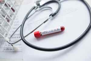 Do you have the dangerous variants of this virus?