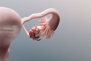 The tumours have shrunk. Is everything gone?