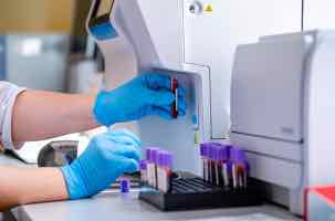All points were abnormal, I’m looking for the cause of anaemia.